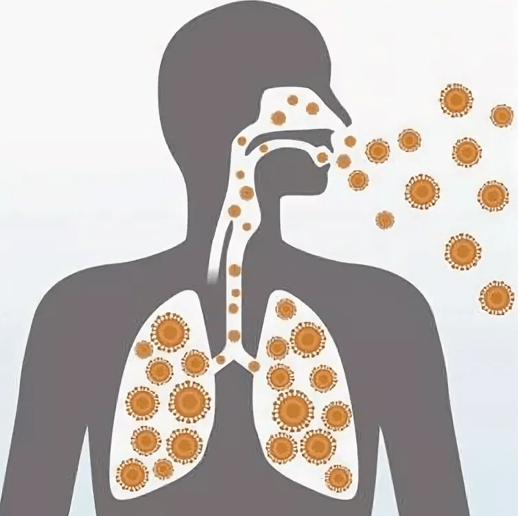 Инфекции верхних дыхательных путей (ИВДП)